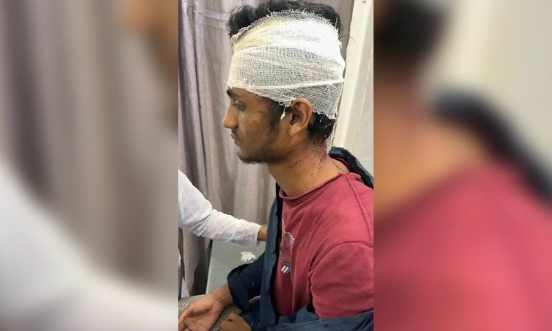 শিবিরের ওয়ার্ড সভাপতিকে কুপিয়েছে ছাত্রদল